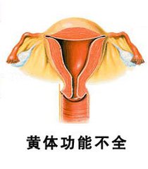 黄体功能不全的发病因素有什么